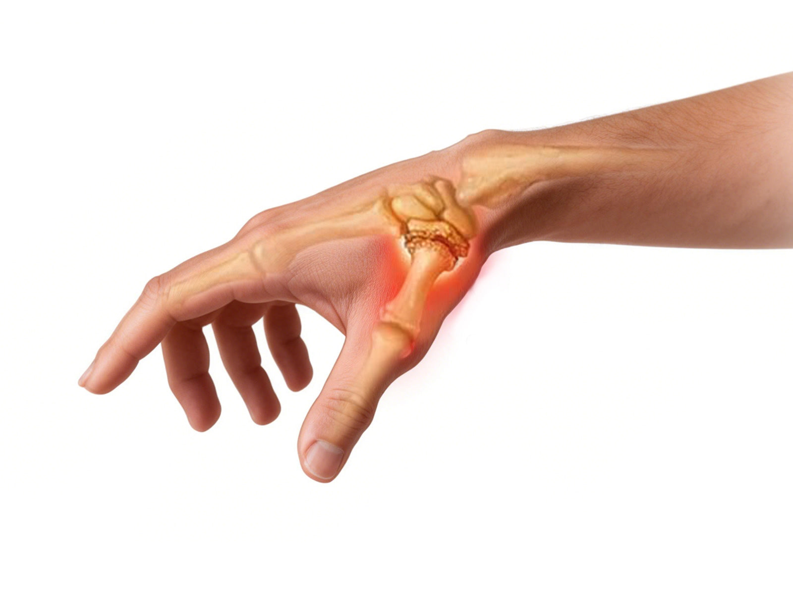 Thumb Arthritis in Women Over 50: Causes, Prevention, and Why CMC Braces Are a Game-Changer